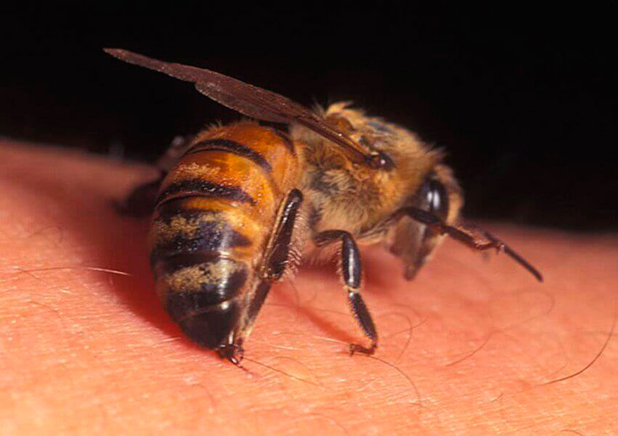 Пчела на коже